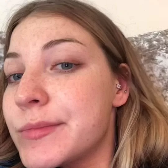 Daisy Kelly turned her struggle with compulsive eyelash pulling into Glow For It, a TikTok beauty brand selling 250,000 lash serums and employing a growing team.